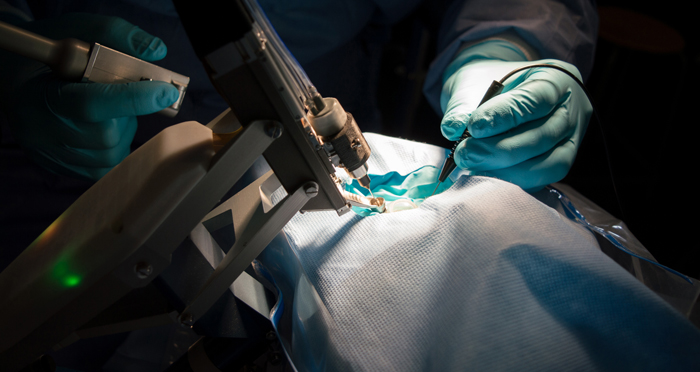 World’s First Robotic Assisted Eye Surgery